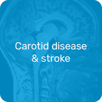 Carotid Disease & Stroke